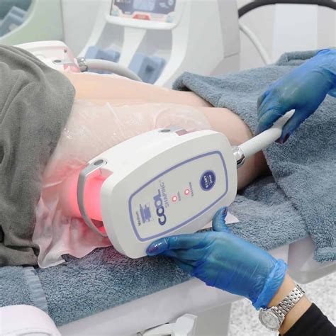 cryolipolysis northbridge|Cryolipolysis for Fat Reduction and Body Contouring: Safety and.